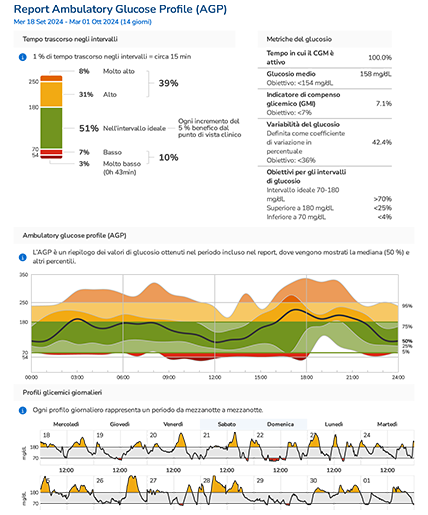 Il report Ambulatory Glucose Profile mostra il tempo nell'intervallo ideale, il tempo di utilizzo del CGM, l’indicatore di glucosio medio, la variabilità del glucosio e gli intervalli ideali.