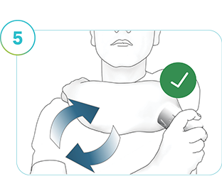 L'immagine mostra una persona che applica un nuovo sensore Accu-Chek SmartGuide in una nuova posizione.